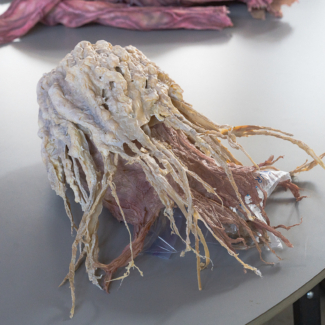 4.6 & 4.7 - Juniper Tree - LA BTS-023